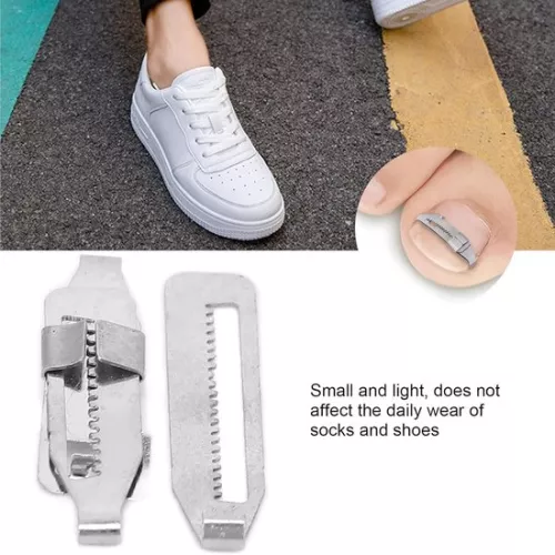 merkloos Ingrown Toenail Corrector 2PCS Stainless Steel Paronychia Correction Tool (8785306004007)