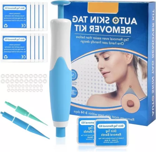 Senza Marchio Skin tag removal kit - Fast acting and safe skin tag remover for small skin tags 2-8mm (6471419702665)