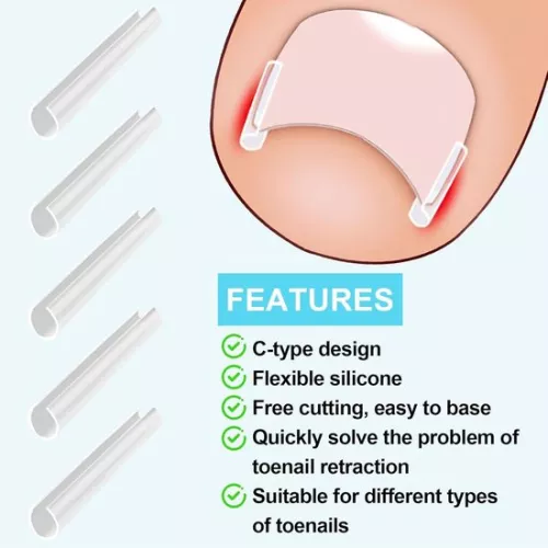 merkloos Ingrown Toenail Correction Kit - 40 Pieces Painless Toenail Smoothing Strips with Toenail Lifter (8785322238837)