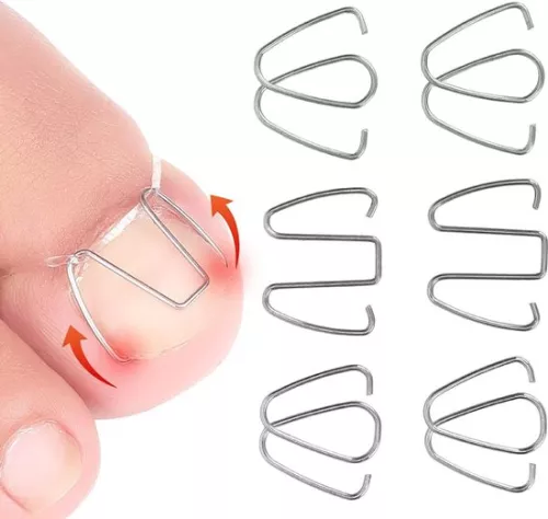 Ingrown Toenail Corrector Hook - Nail Correction Strips Thread Lifter Tool for Recovery - Women Men Corrector .