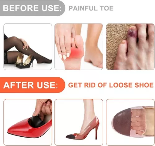 3 Pairs of Toe Fillers - Inserts for Oversized Shoes - Adjustable Shoe Pads